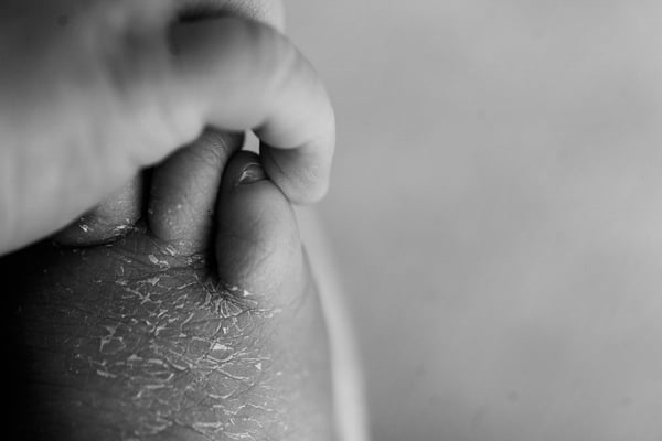 Macro of a newborn's foot, the first days' skin flaking across the heel